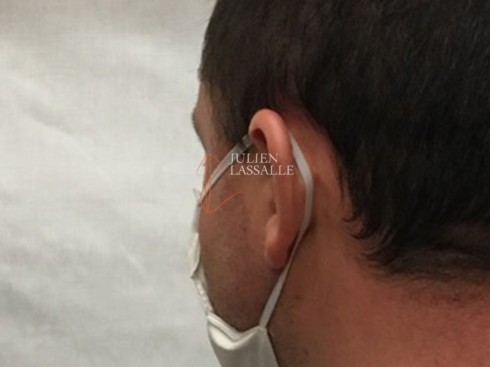 Masque barrière AFNOR SPEC S76-001 tissus technique catégorie 2