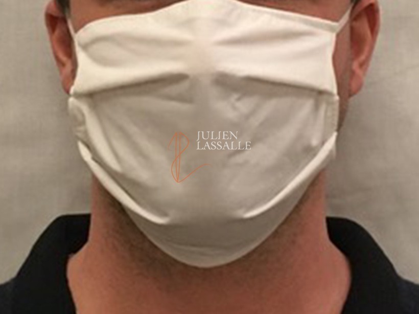 Masque barrière AFNOR SPEC S76-001 tissus technique catégorie 2